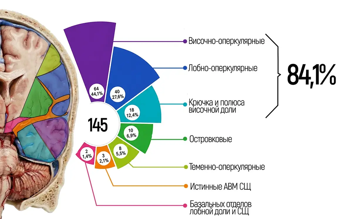 Распределение АВМ по областям сильвиевой щели в серии из 145 пациентов. Большинство узлов приходится на височно-оперкулярную и лобно-оперкулярную области.