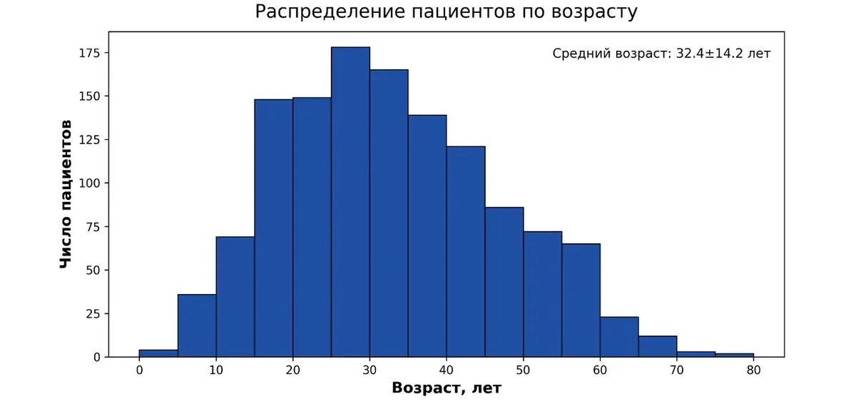 Распределение пациентов с АВМ по возрасту. Пик приходится на 20–40 лет, средний возраст около 32 лет.